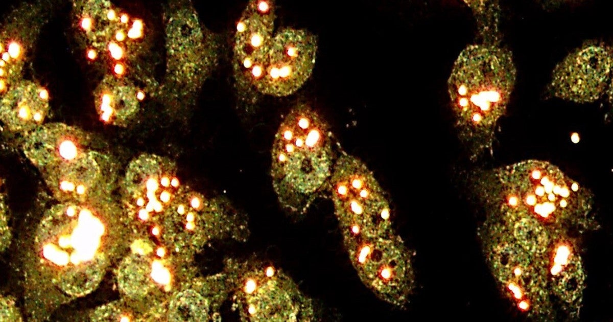 ナノ材料の細胞内輸送を効率化するらせん渦 | 沖縄科学技術大学院大学